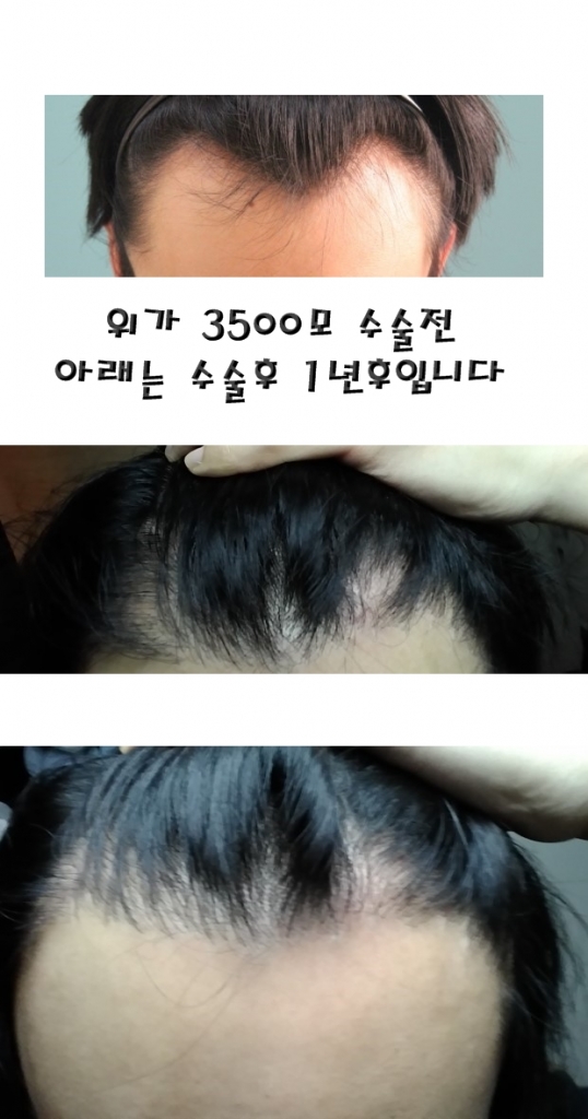 전후