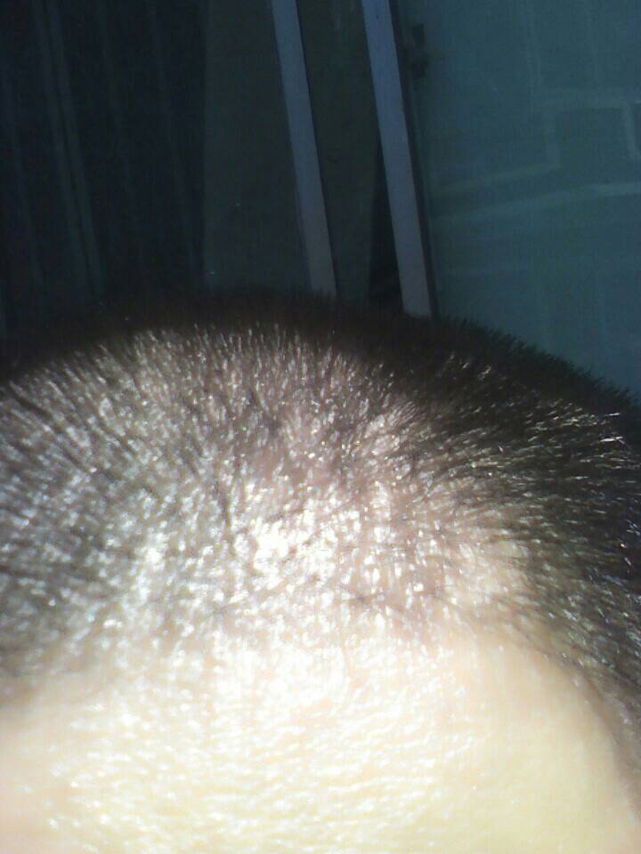 1440156138907.jpg