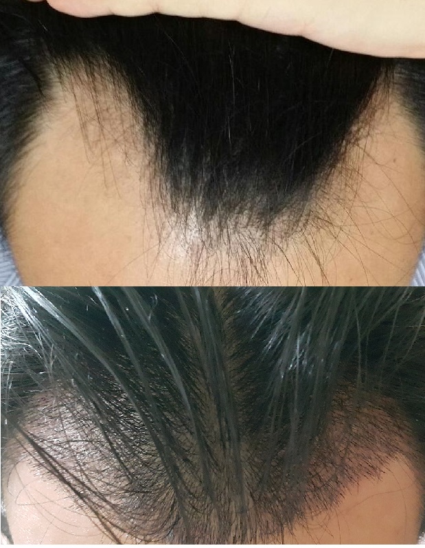 20151025비교.jpg
