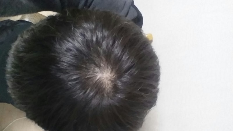 20151122_173522.jpg