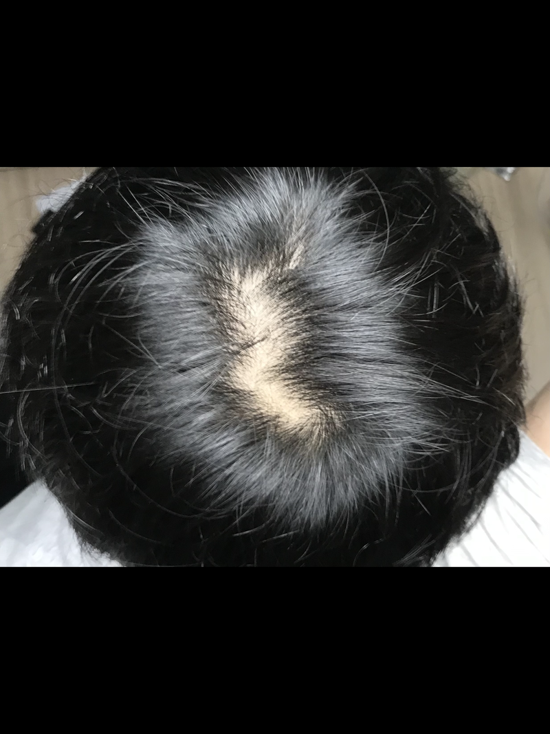 00B0EFEB-00D7-4B38-AEDB-7372B1C7DA91.png