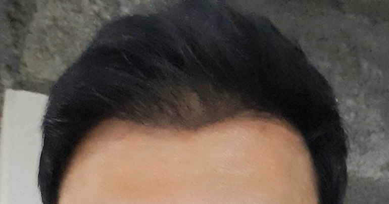 20190309_083711.jpg