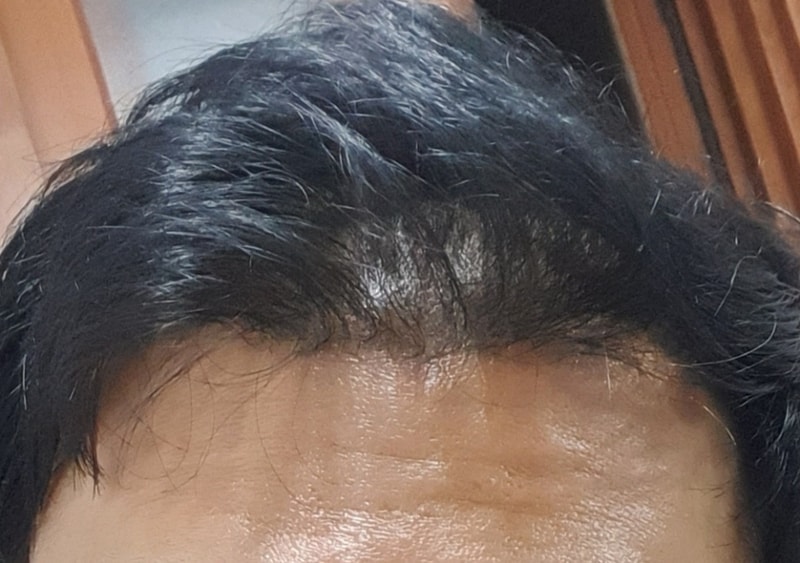 20190309_083915.jpg