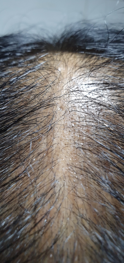 20190305_210115.jpg