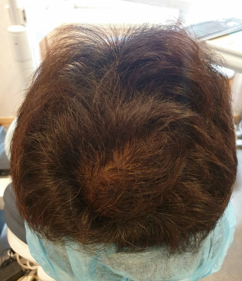 12회차 후 -1.jpg