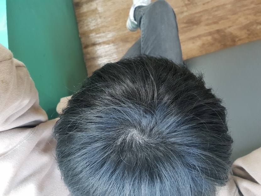 정수리 부분입니다
