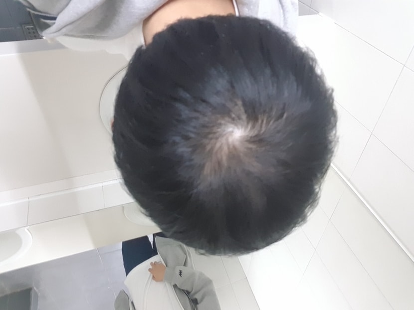 드라이 등으로 최대한 가린 후 밖에서 찍은 사진