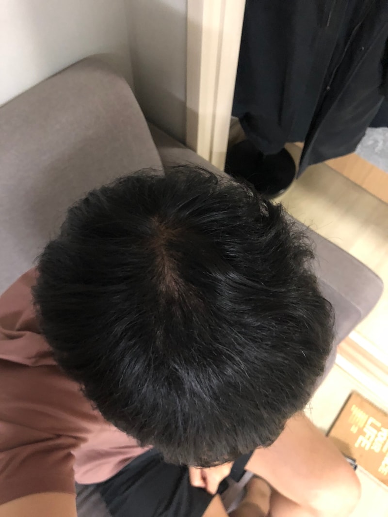 정수리 2.jpg