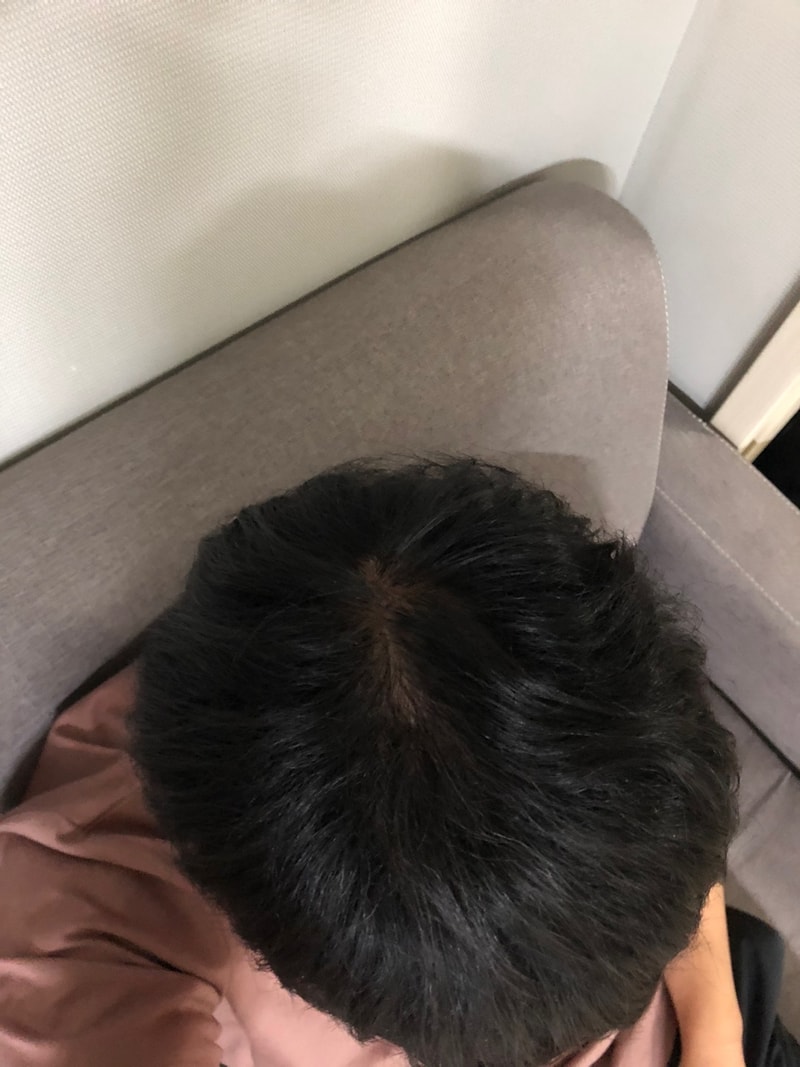 정수리 1.jpg