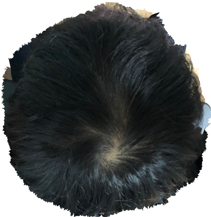 3.png