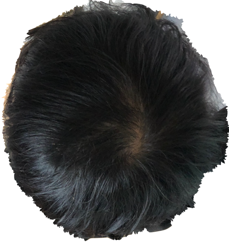 1.png