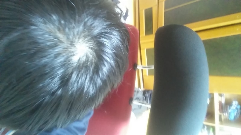 20170305_053139.jpg
