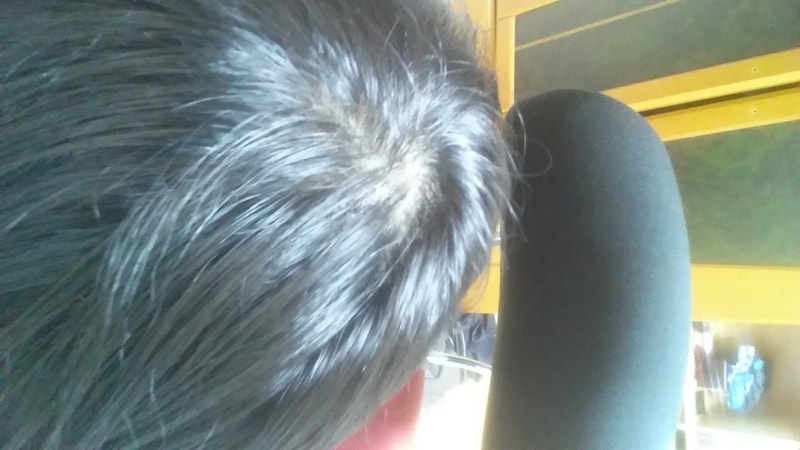20170305_053137.jpg
