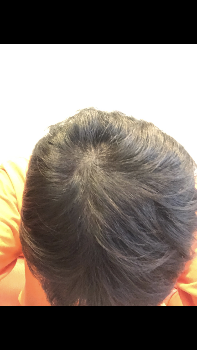 6B8271C9-53D2-43ED-82B9-D143241CC5C1.png