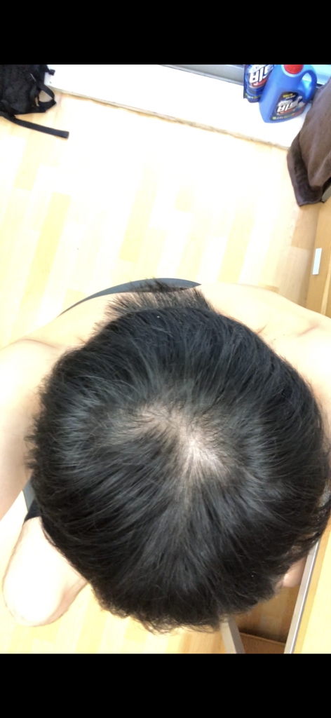 6DDB93CF-793A-499F-9DC5-DB64B12F82C1.png