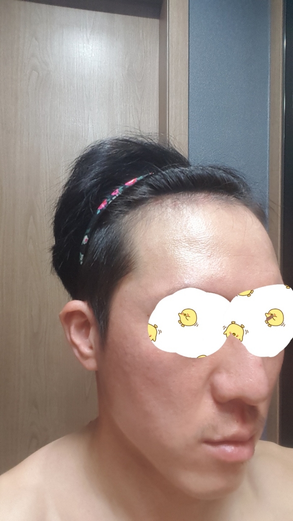 우측