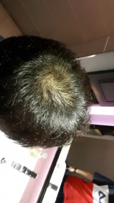 IMG_20170730_205251.jpg.jpg