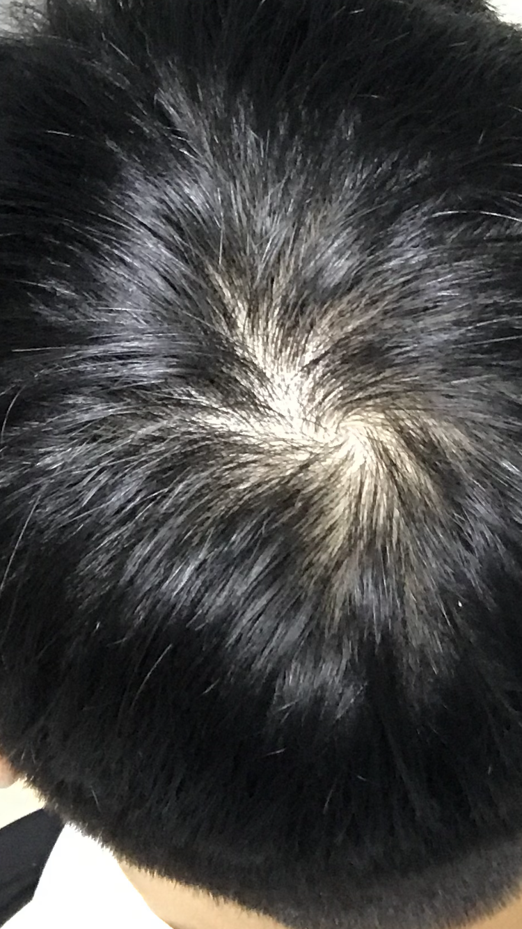 0D35C52F-D551-43F7-B2E9-C173895EB1A0.png
