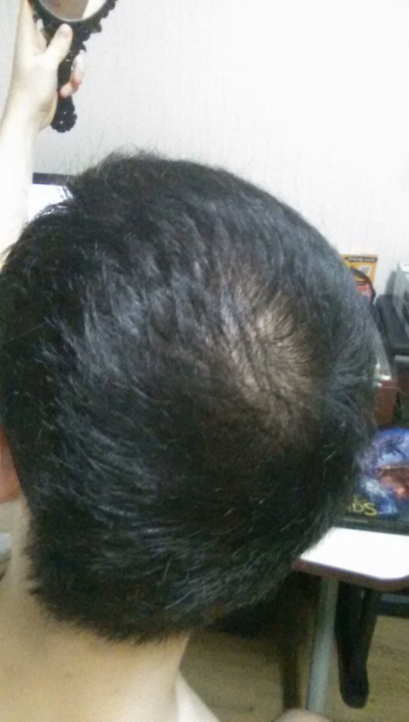 CAM00818.jpg