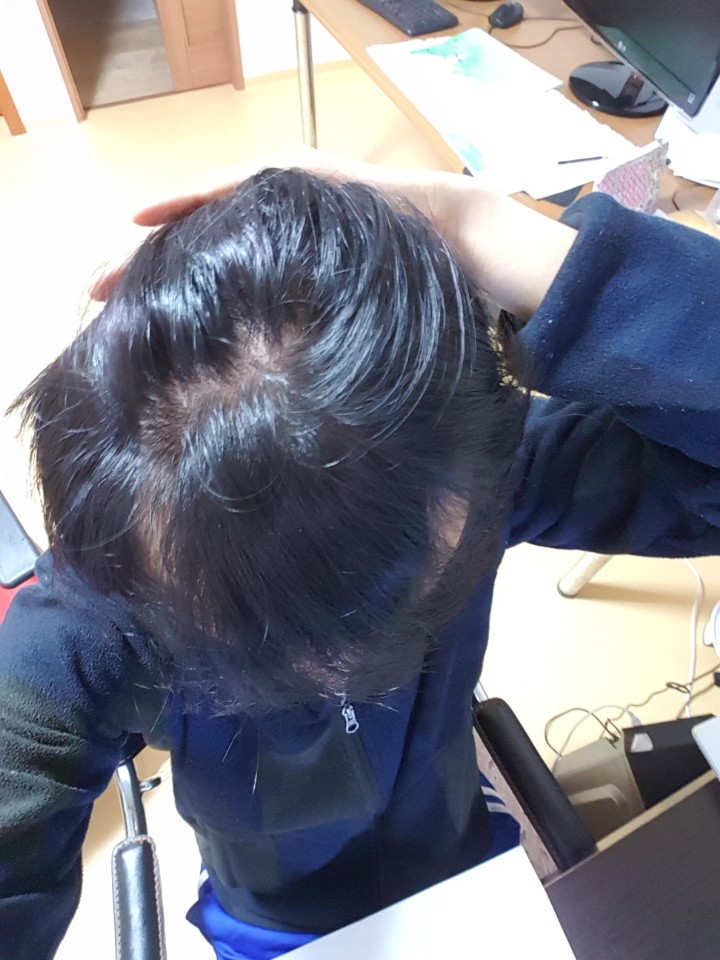 조명에 속알머리