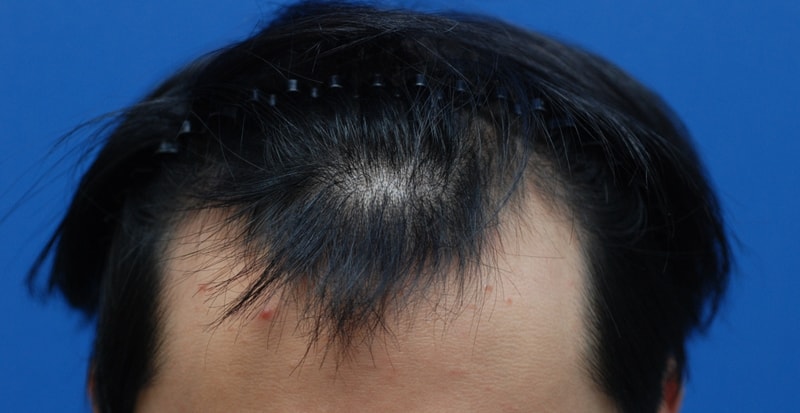 박성모_01_HG_수술디자인.jpg