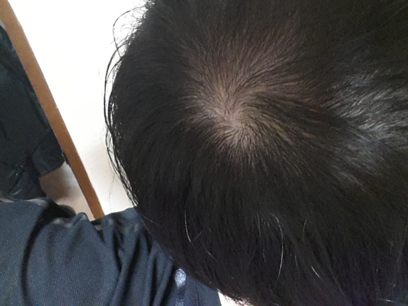 20140214정수리.jpg