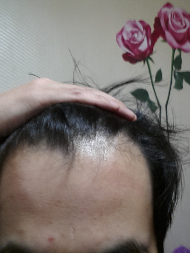 20140214이마.jpg