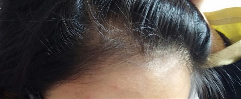 20150221_203004-1.jpg