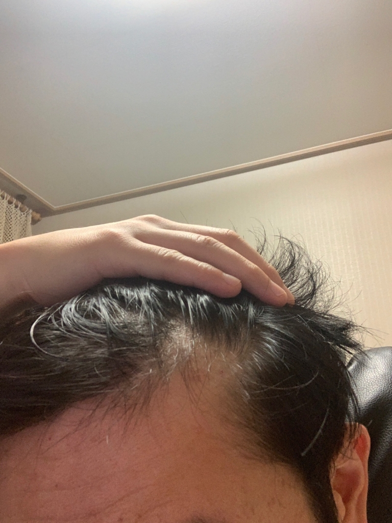 KakaoTalk_20190730_213356023_06.jpg