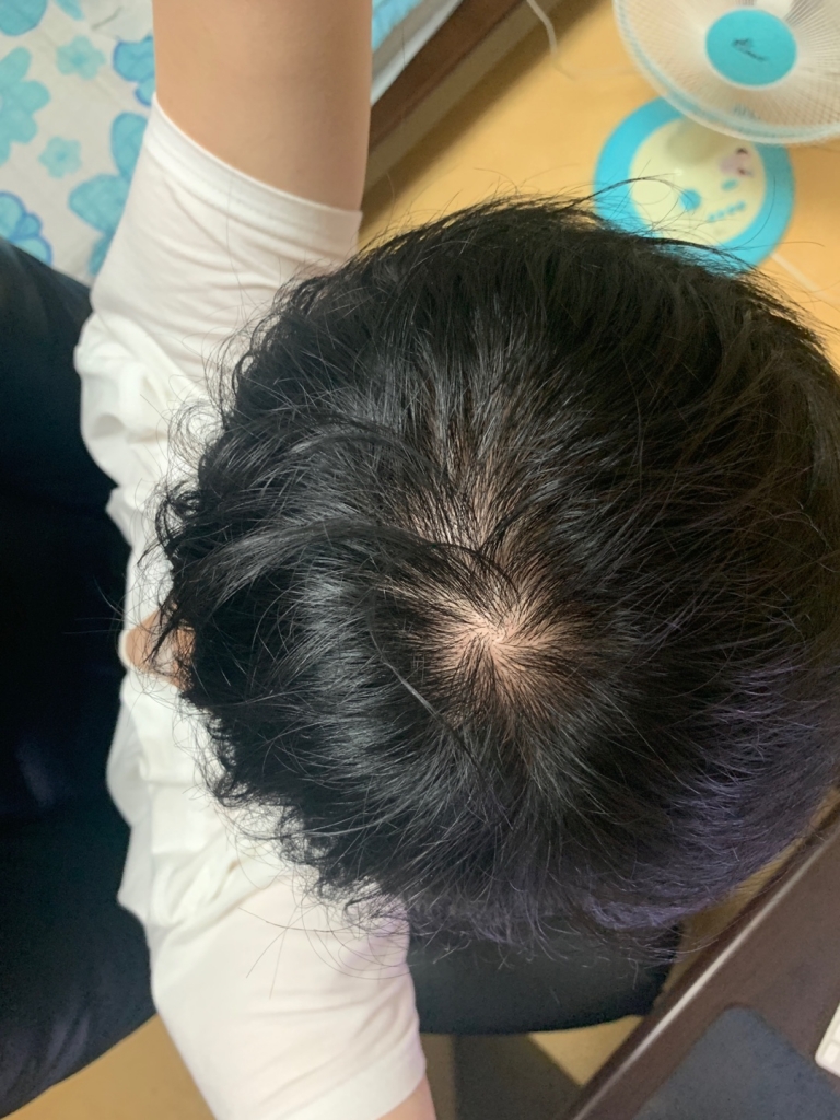 KakaoTalk_20190730_213356023_01.jpg