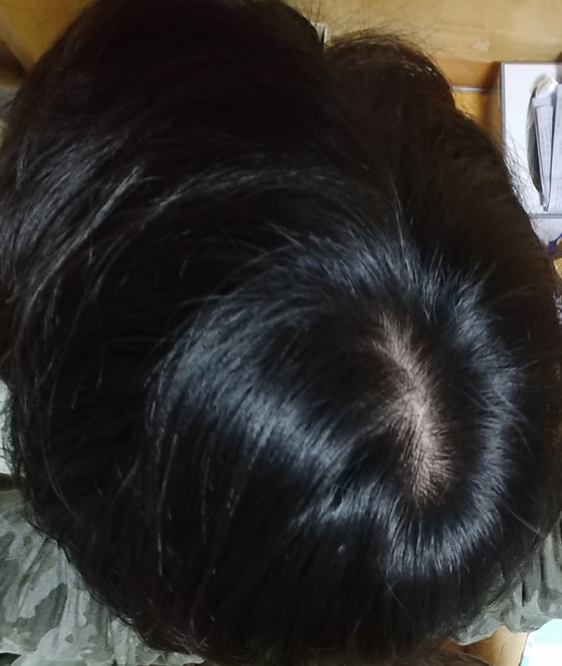 KakaoTalk_20180304_201533623.jpg