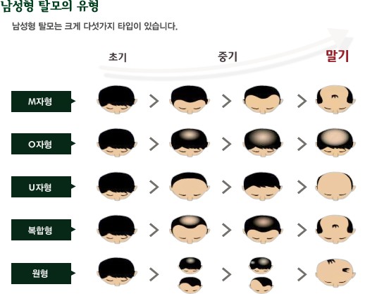 유형.jpg