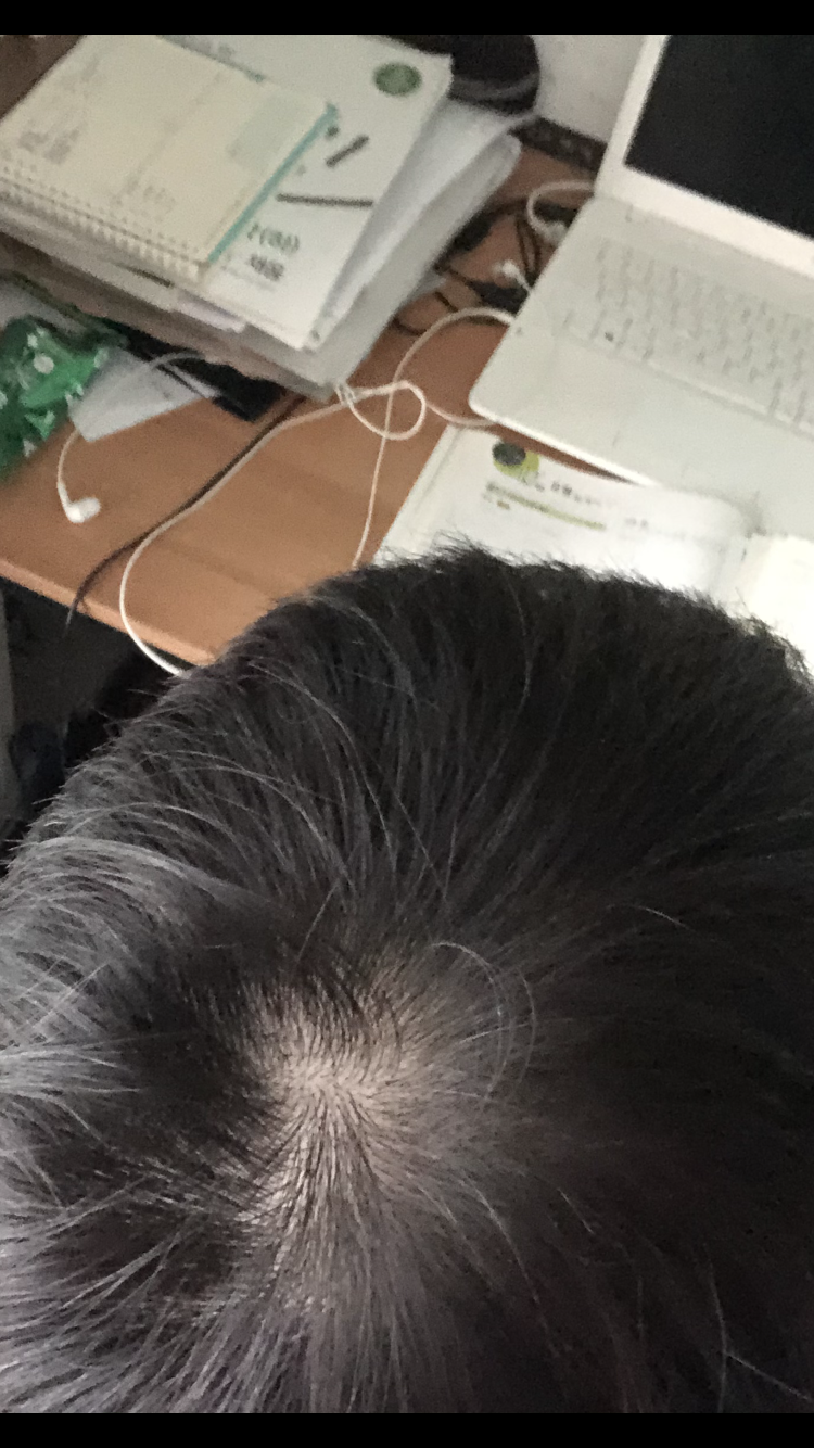 6D65A8EF-F7BF-4B92-88D6-50A322C45CB0.png