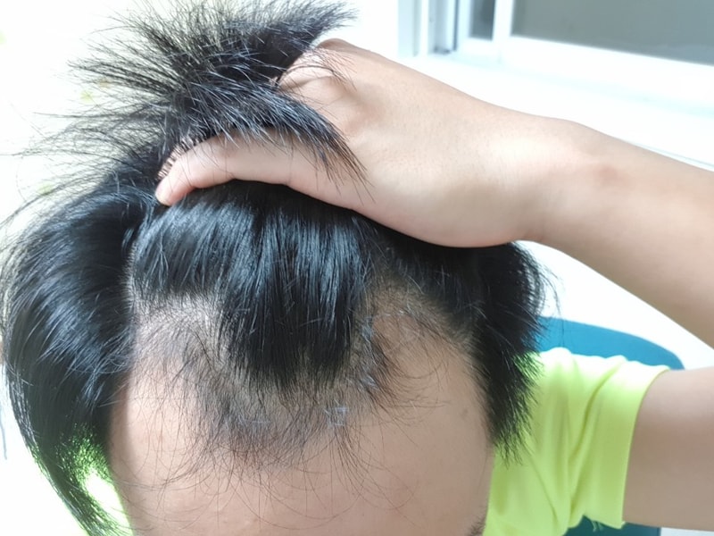KakaoTalk_20170821_215849551.jpg