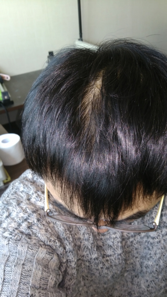 크기변환_20160310_170839.jpg