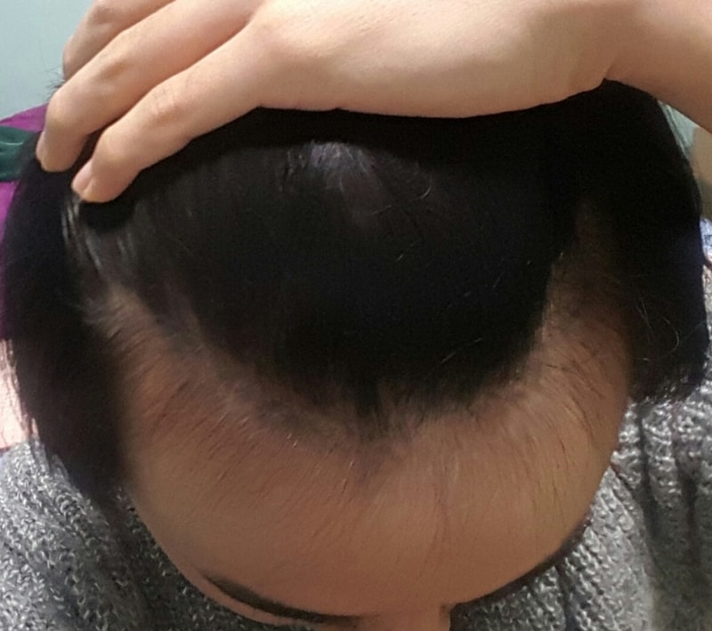 20161211_172515.jpg