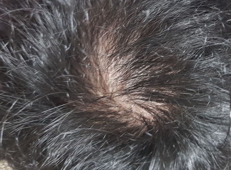 캡처2.JPG