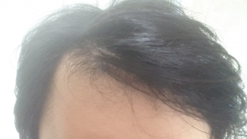 20150617_002132.jpg