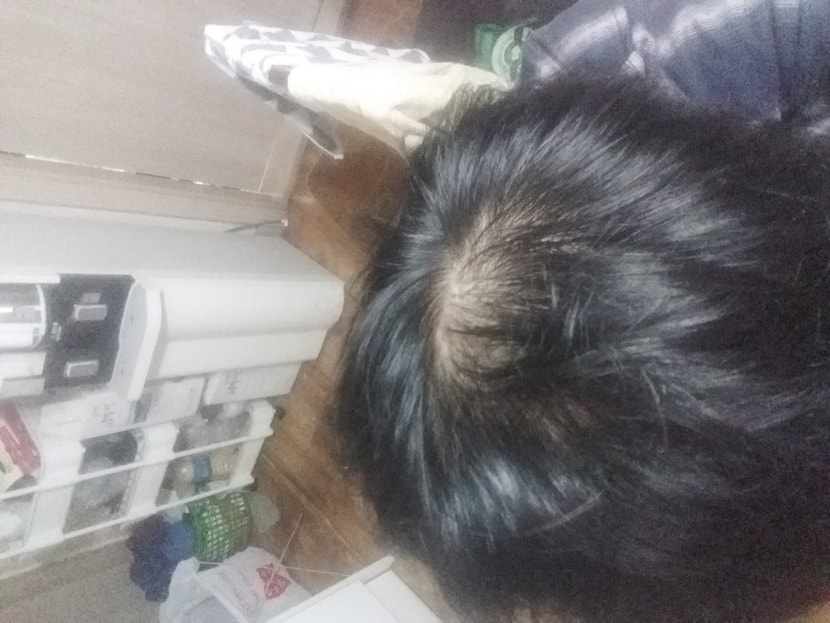 먹기전 