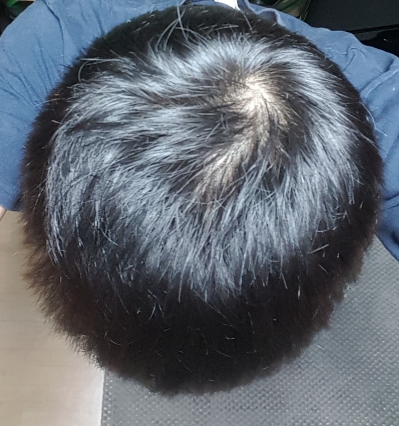 20170929_205239.jpg