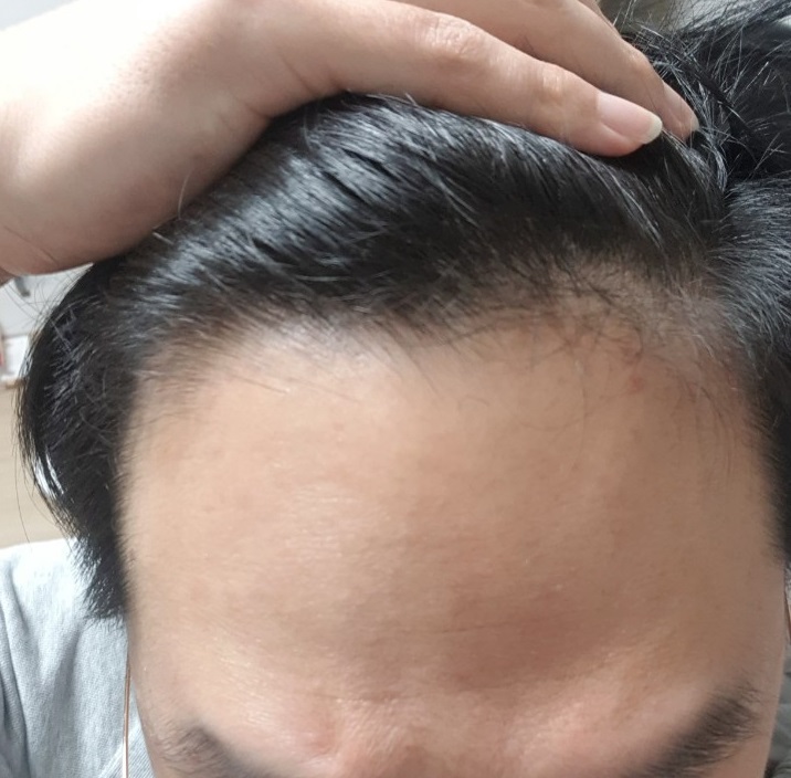앞머리