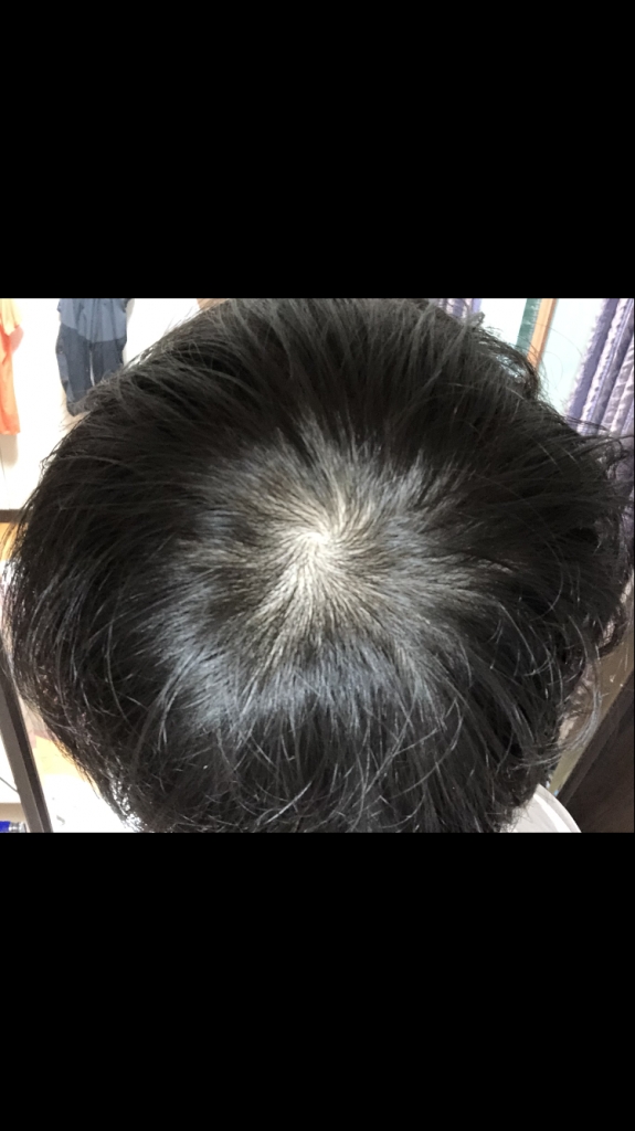 90D45929-DA14-45BD-A94C-A15ACBB01A5E.png