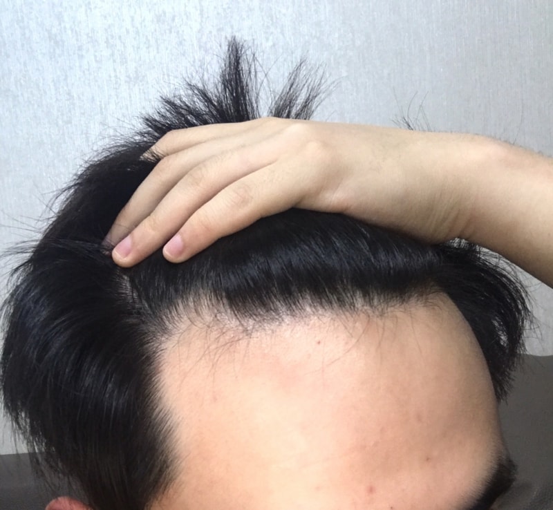 20170710_2.jpg