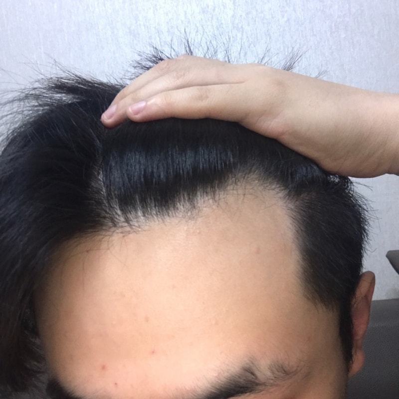 20170710_1.jpg