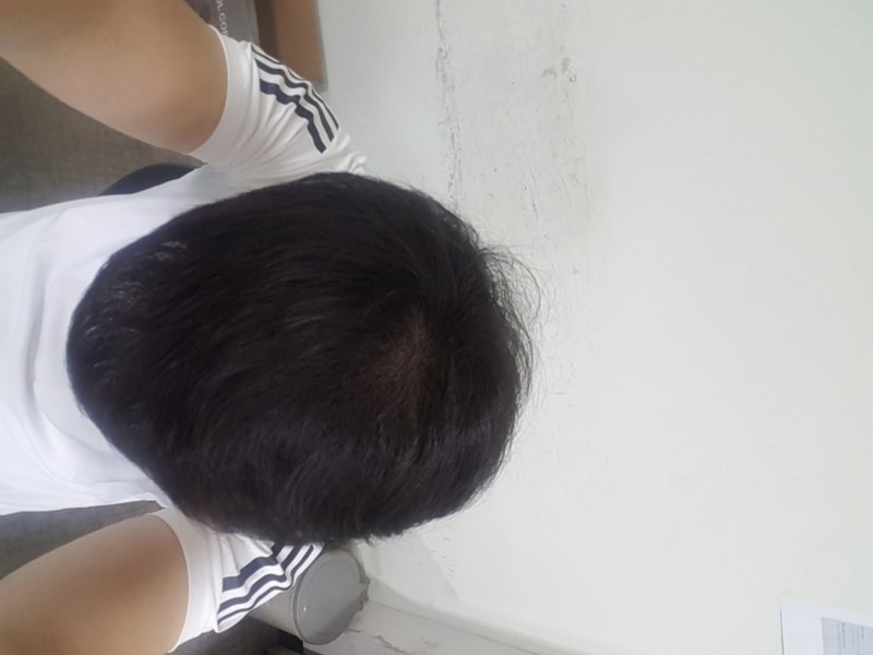 20170704_174323.jpg