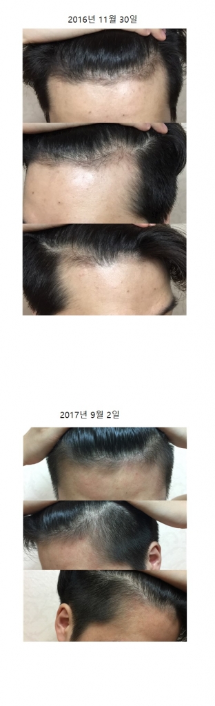 비교사진.jpg