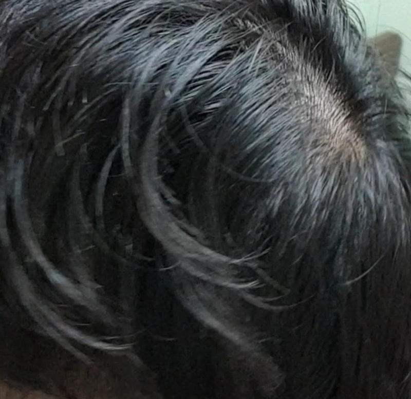 20190315_023230.jpg