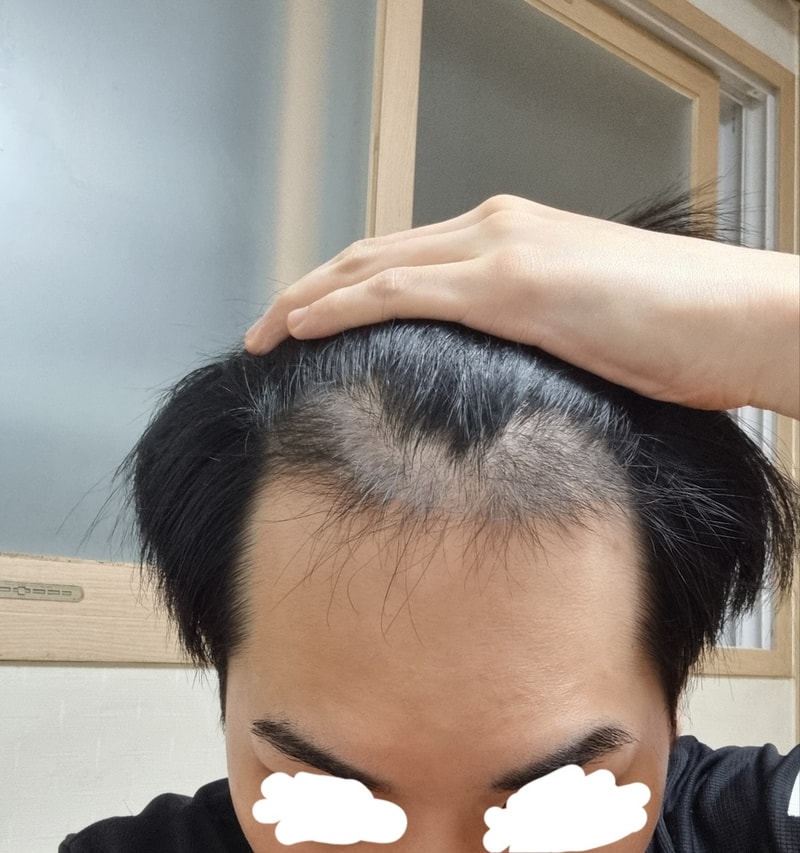 앞머리 4.jpg