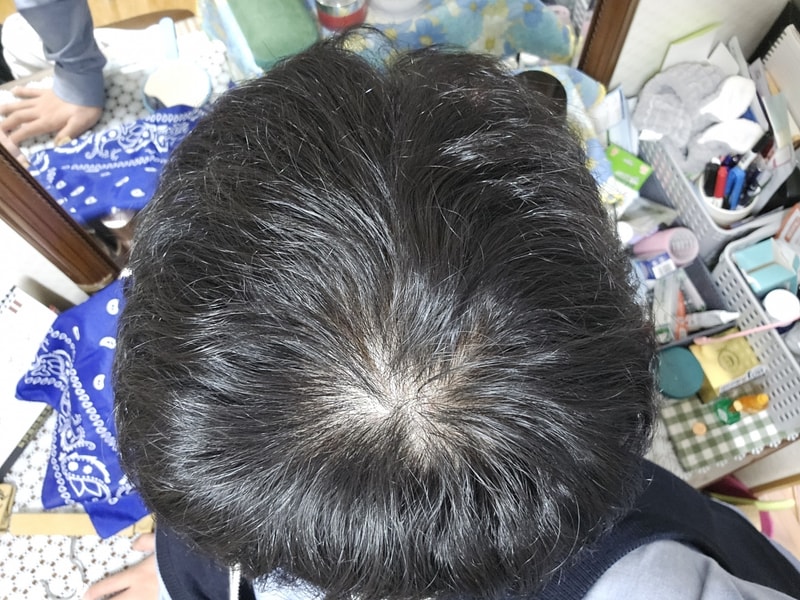 1000038330.jpg