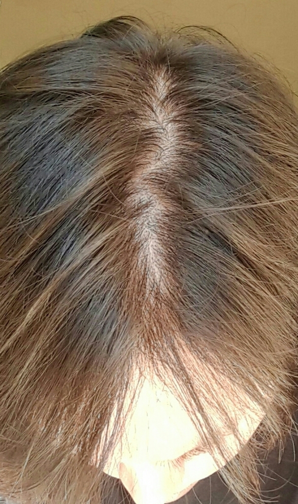 20160908_151314-1-1-1.jpg
